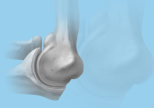 elbow illustration